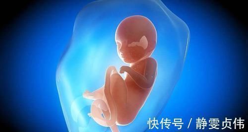 怀孕|6个月脐带扭转导致胎停,是什么原因造成?以后怀孕要怎么注意?