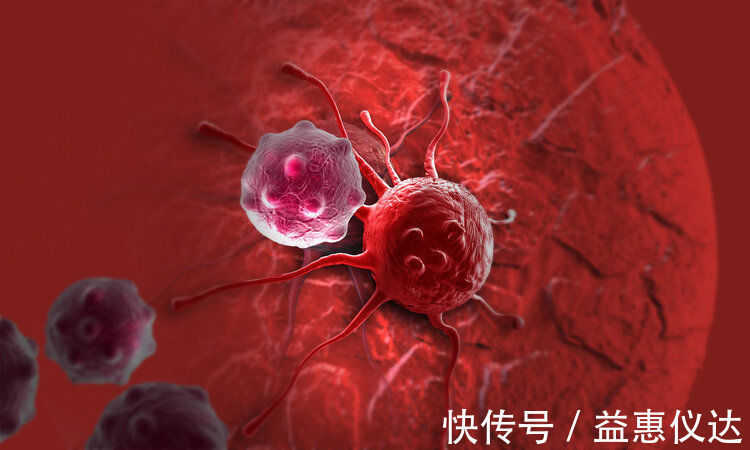 复发|抗癌的关键不是手术患癌14年无复发,肿瘤院长劝人别轻易开刀