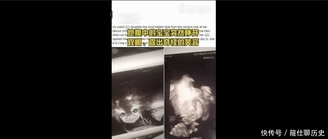 伊安娜|孕妇做B超被吓坏,孩子突然睁眼怪笑!医生却说……