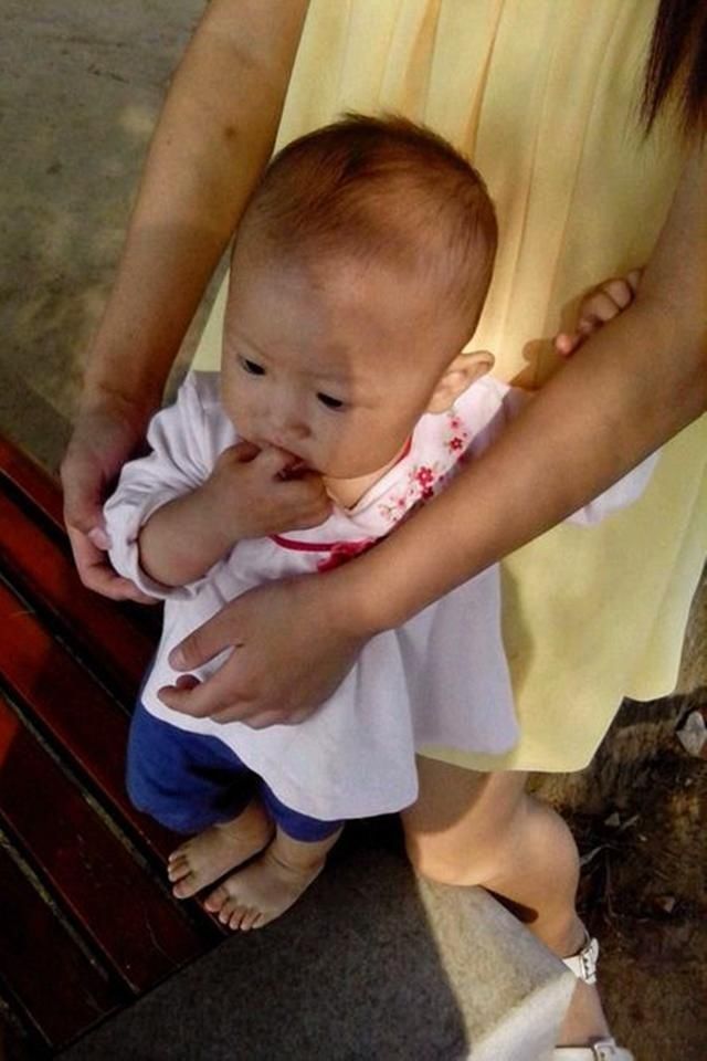 小宝宝|娃的睡姿不当会影响耳朵发育,导致“招风耳”3个问题一次说清