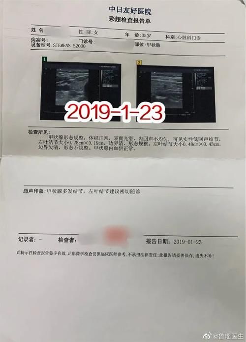 B超怀疑甲状腺结节恶性，甲穿提示为良性，基因检测到有突变，到底是“良性”还是“恶性”？