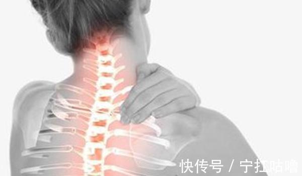 颈椎病|自用颈椎病药贴,千万不要乱用了啦!