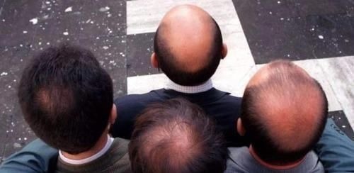 男人四十|男人开始衰老时,身体会发出4个信号,不妨自测下看自己占了几个