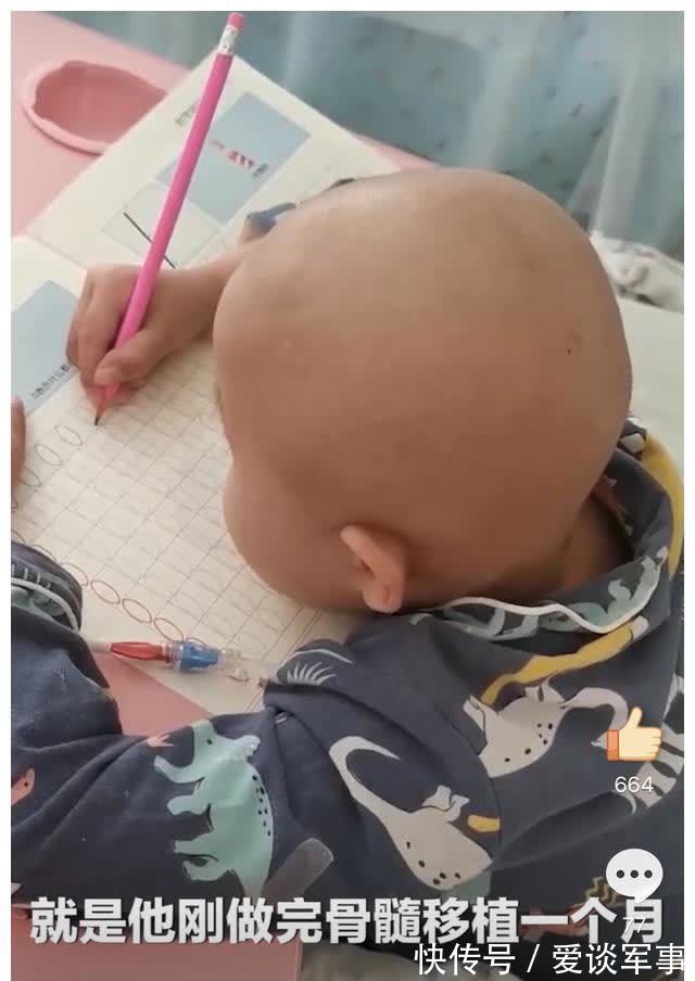 消毒|7岁男童骨髓移植后自己用棉签消毒,抽血时从来不哭,想快点上学