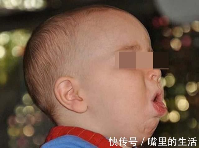 排出体外|新生儿出现这9个问题,很容易吓到妈妈,其实都是正常现象