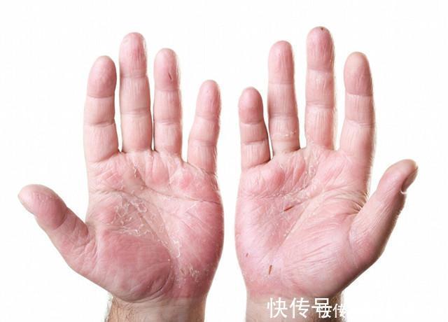 味甘平|发现身体4个状况别死扛,说明肝已经坏了一半,最好吃点这种食物