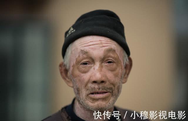 肝癌|78岁老人因肝癌离世,医生:太多人还在吃,家里都有