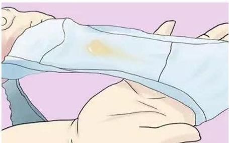 女孩子|女孩子瞄一眼内“裤”若出现这3印记，八成是宫颈癌“兴妖作怪”