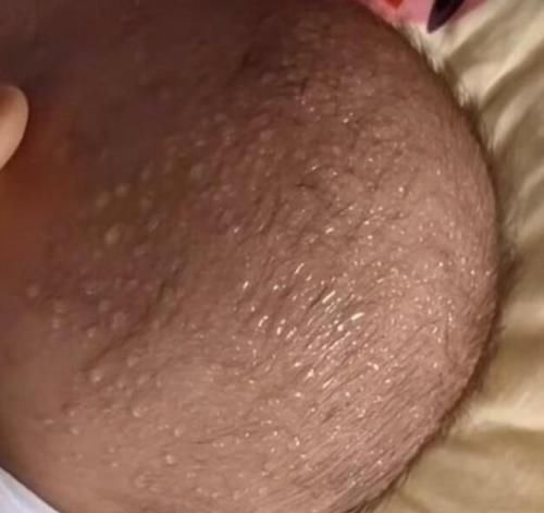 消化|吃一次相同于半月不消化,父母还在喂孩子吃,医生:脾都烂完了