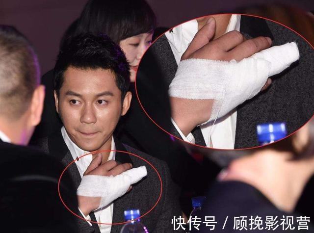 盘点|盘点因综艺节目受伤的三位明星，李晨只是缝针，他却因此丢了性命