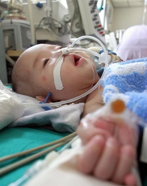 先天性心脏病|心脏彩超能检查出什么病来?心血管医生:这几种心脏病都可以