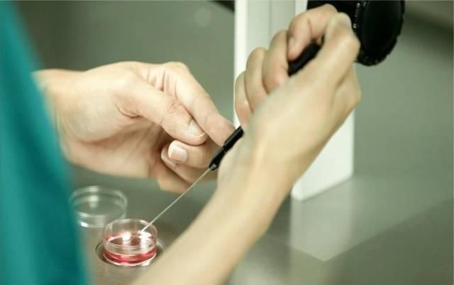 试管婴儿|国内首例试管婴儿已31岁,现状让不少人失望了,好处不得不提