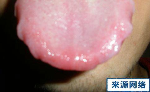 祛湿|湿气的“七寸”在哪里你抓对了吗湿重，少做3事，贵在坚持