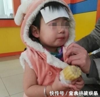 孩子|孩子积食脾虚,小脸先知!脸部这4个异常,若占一个,家长需上心