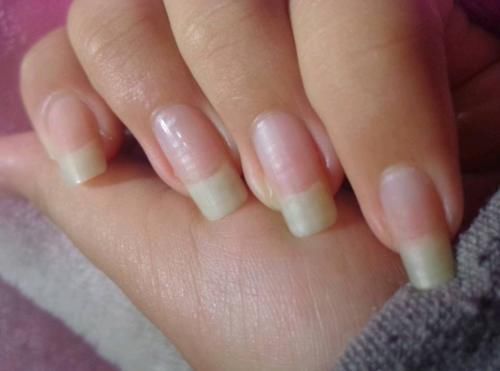 毛细血管|人闲下来是不是容易长指甲,心宽的人是不是容易长头发?