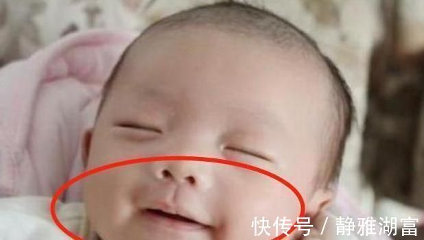 手术治疗|2岁孙子总咧嘴笑,奶奶发现不对劲急忙送医,医生幸好发现及时