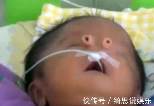 丈夫|孕妇怀孕8个月,丈夫坚持要求剖腹产,孩子出生后,全家乱成一团