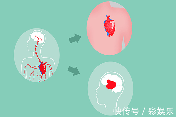运动|坚持步行,到底是养生还是伤身长期步行的人,身体如何了