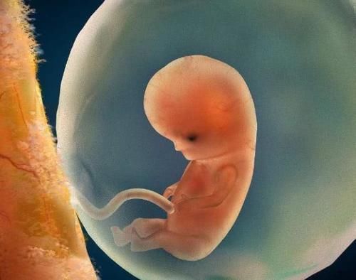 静怡|怀孕后,为何有人一直吐,有人却从不吐原因和腹中胎儿有关