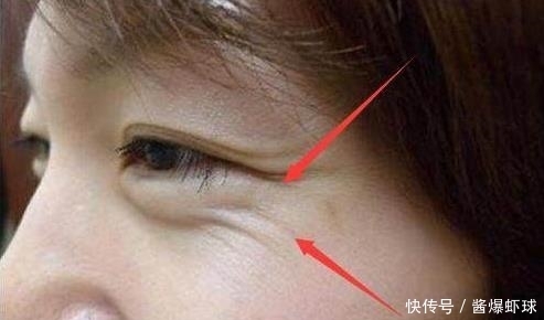 皮肤|女人最怕长皱纹显老!每天睡前抹点“它”,皮肤白皙水嫩又紧致