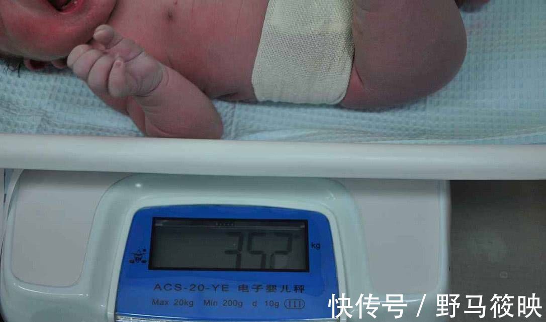 医生|新生儿出生后,医生为什么要告诉婴儿体重你应该知道原因