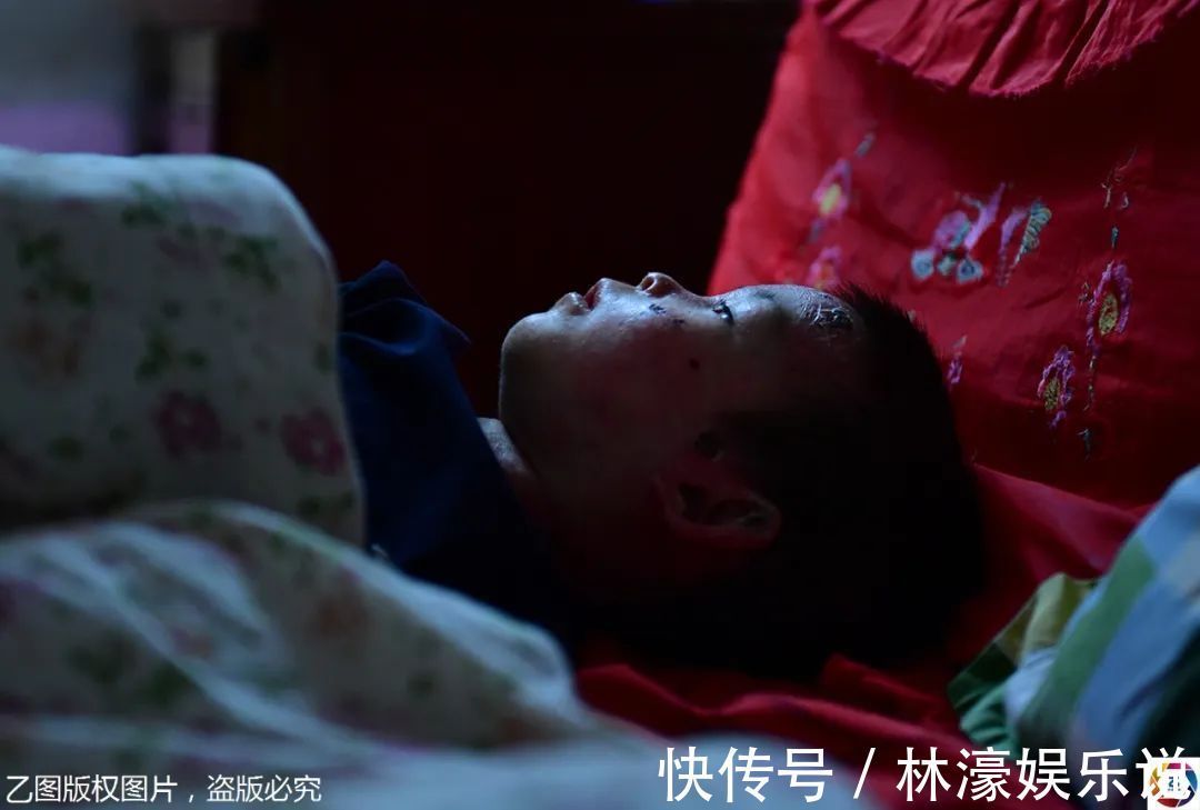 纱布|男童出生患罕见病,三年用掉纱布5000多圈,每天只能坐在床上