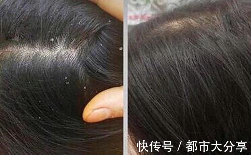 小马甲|一款“默默无闻”的洗发水,效果不输大牌,网友用完头发更好了!