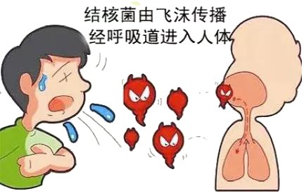 结核|与肺结核患者分餐筷就可以避免被传染吗？