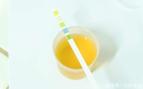 别忘了|肾出问题小便来提醒!尿完别忘了看一眼,及时发现异样