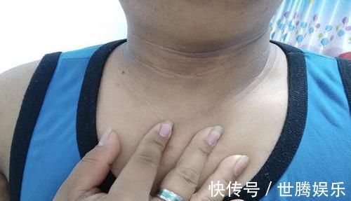 生活水平|6岁女儿脖颈发黑洗不掉,送医院检查,医生的解释令宝妈哭笑不得