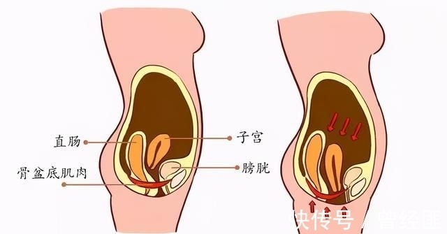 便秘|产后便秘怎么办?
