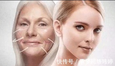 蛋白线|看完这个,你还敢做线雕隆鼻吗?