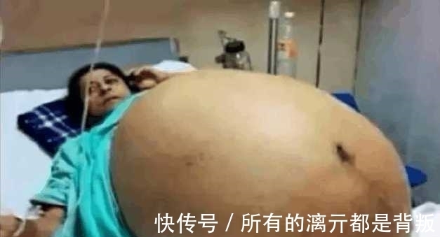 女子肚|女子肚大如鼓, 竟生下11胞胎, 结果却让全家人犯愁!
