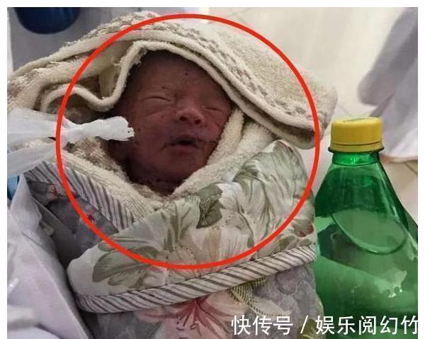 宝妈|宝宝出生后“没肛门”,夫妻俩急忙送医检查,医生:都怪你丈夫