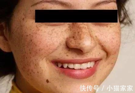 护肤品 哪些皮肤问题是护肤品不能解决的!