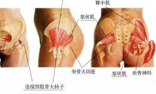 坐得多会痛 原来是梨状肌综合症 又叫 富贵病 快资讯