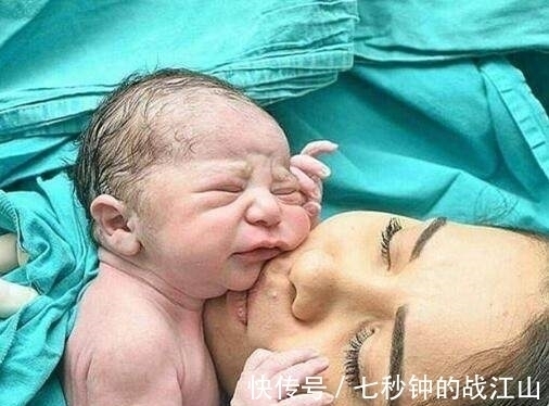 剖腹|刚剖腹出来的宝宝伸手抓住医生的剪刀,不让剪断脐带!