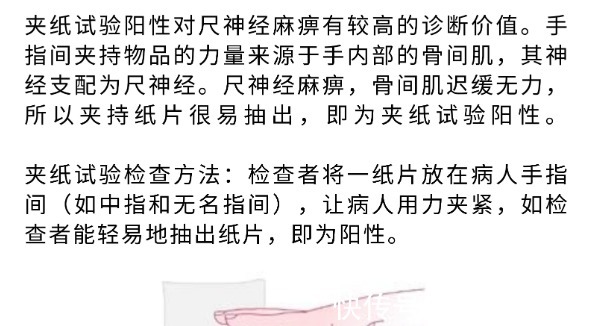 无名指|年轻女孩手指麻木几个月了,怀疑是颈椎病导致的,结果却不是