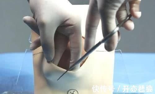 无痛分娩针|生孩子时,都会遇到哪些突发情况这6大状况,孕妈不妨先了解下