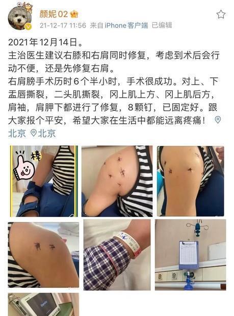 社交平台|中国女排受质疑，3大主力接连手术，朱婷出国，球队或迎来大变动