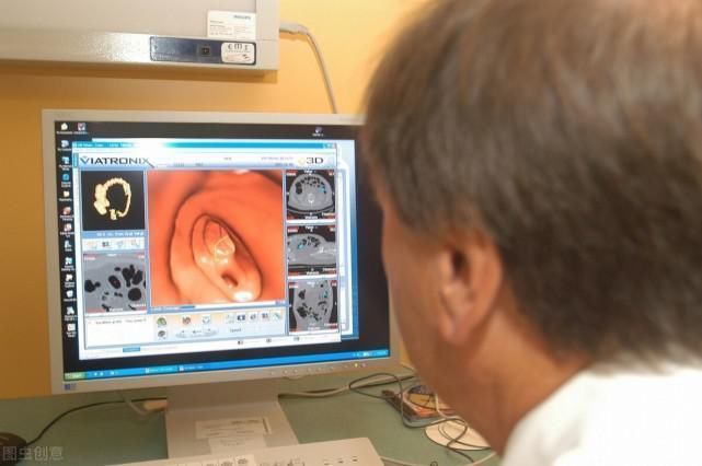 息肉|体检发现肠息肉,久拖不治,2年后癌变!提醒:3种息肉最好切除