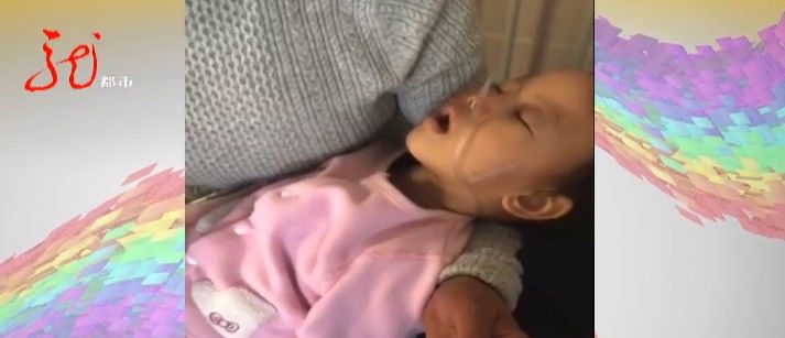 儿童医院|哈尔滨一岁女童浑身淤青、口腔淤血……她不幸被确诊，父母崩溃了！