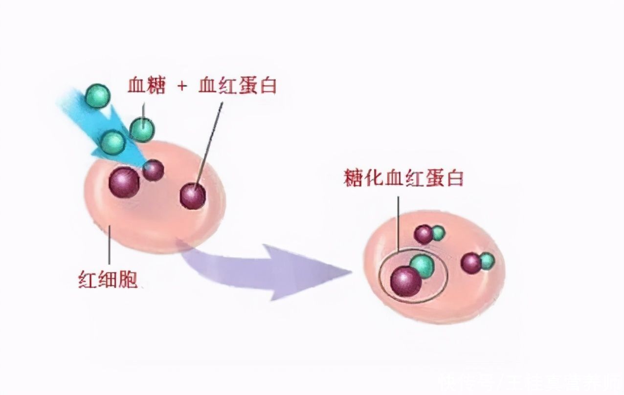 糖化血红蛋白|除了血糖和糖化血红蛋白,糖友更要关注一个指标,别不当回事