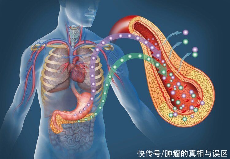 防癌|每个人都有癌症基因？专家公开4组防癌密码，让你受益一辈子