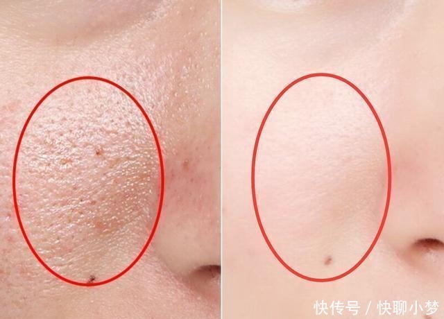 产品|皮肤科医生提醒:这几款火爆全网的护肤品,含有刺激性激素