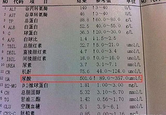  不错|尿酸高的人，睡觉时有3个表现，若没有，尿酸控制得还不错！