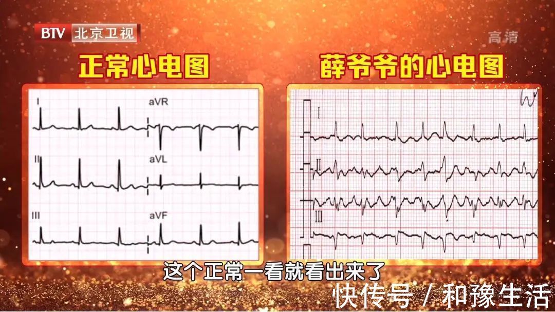 头晕头痛|心跳过慢、过快、乱跳，都是因为它出了问题！一个小方法，提早发现危机~