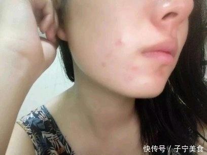 评测告诉你,这些产品祛痘淡印最有效