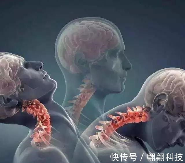 母鸡|有一种树枝,是颈椎病“死敌”!这就是中国人的智慧