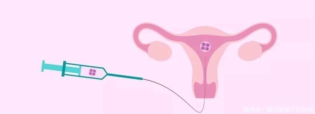 b超检查|35岁孕妇22周四维却发现子宫没有胎儿,孩子哪去了呢